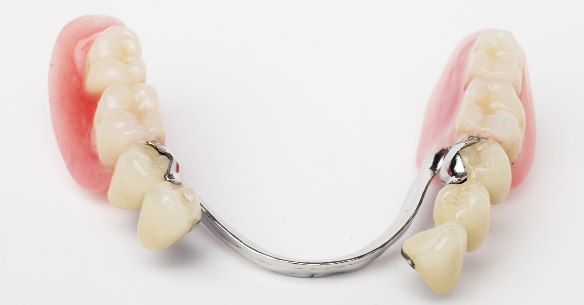 Descubra a relação das próteses dentárias com a missão da Odontologia