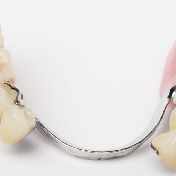 Descubra a relação das próteses dentárias com a missão da Odontologia