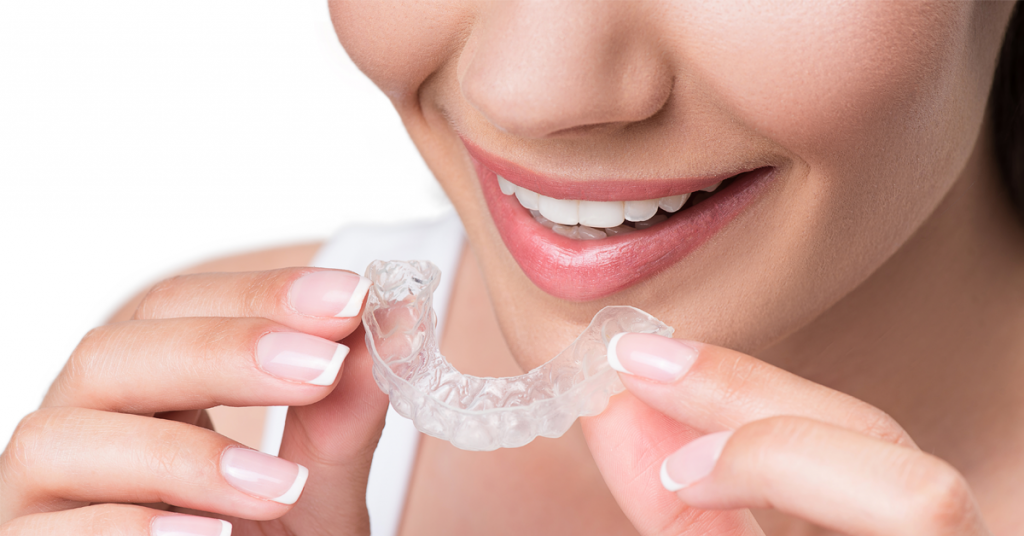 Descubra as vantagens do aparelho ortodôntico Invisalign